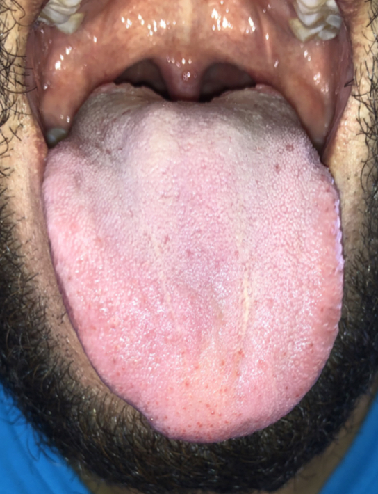 Podcast: Venas Varicosas