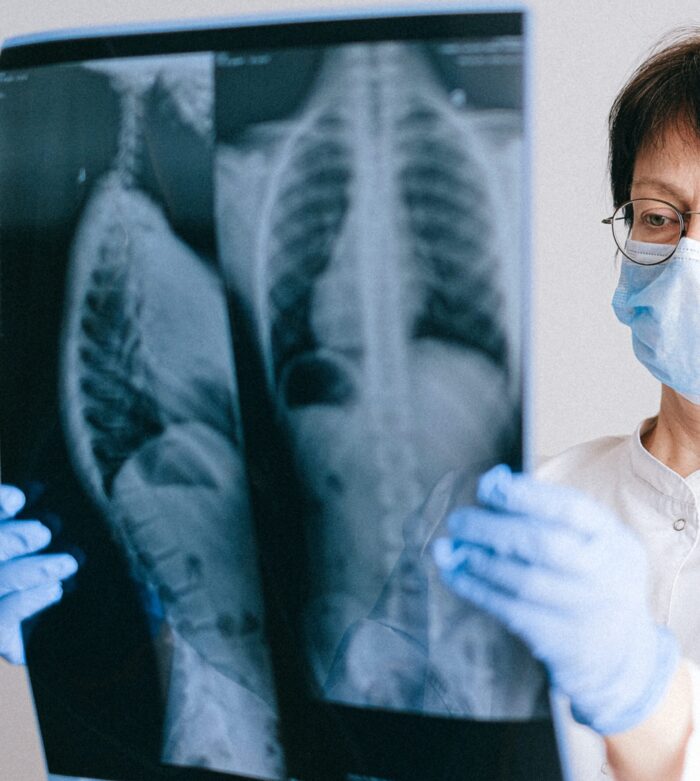 T. 2 | EP. 5 : Acupuntura Distal y Dolor Lumbar